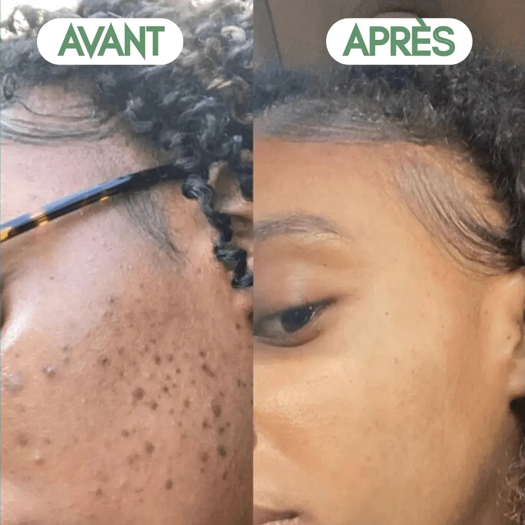 Green Mask Stick | Masque Purifiant & Anti-Points Noirs 🌱